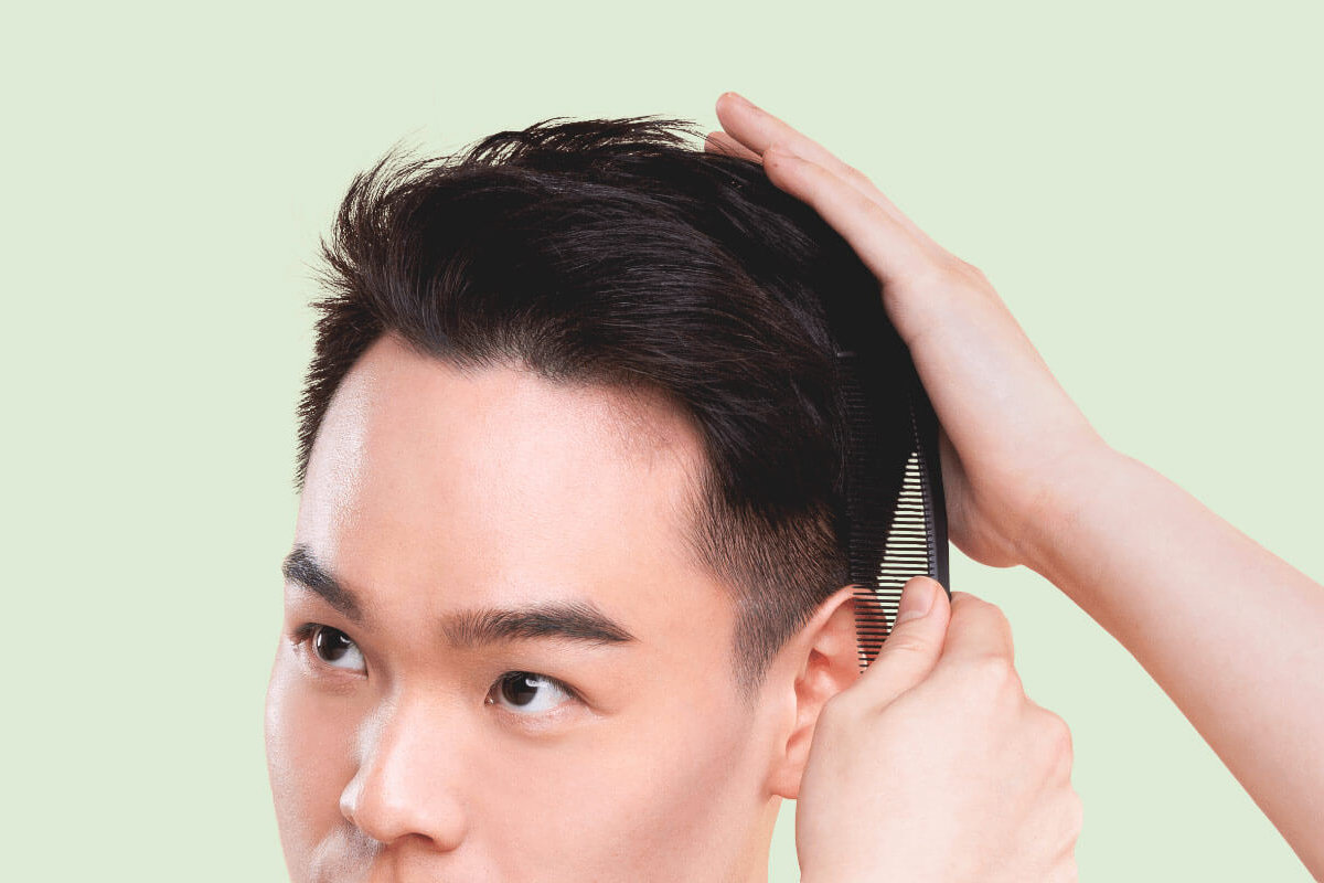 Watch Out For These 5 Signs Of Hair Thinning | AndSons