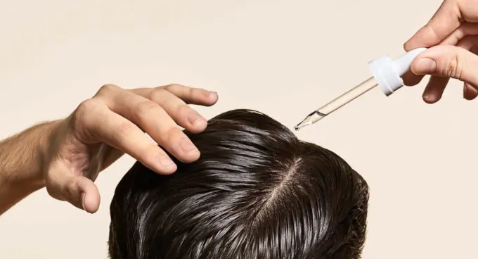 Hair Loss In Men: Things You Need to Know 1 hairloss in men