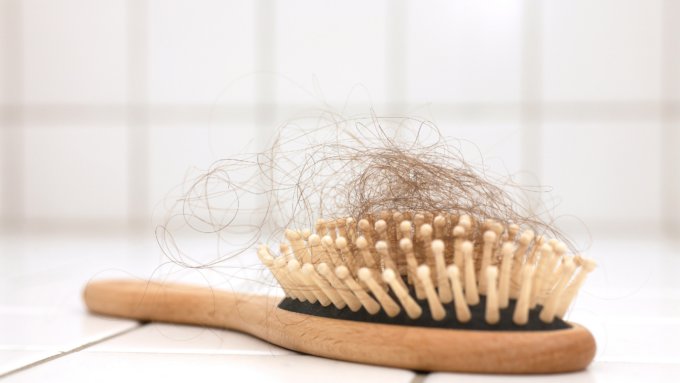 hair loss remedies