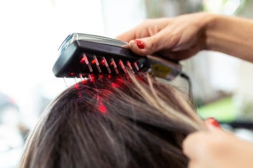What Are The Key Reasons For Hair Loss In Men Under 25? 9 Laser combs