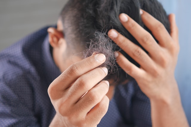 Testosterone Supplements: What Are They And How To Choose One? 2 Hair Loss