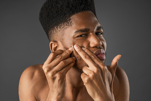 What Is Hormonal Acne In Men? 6 istockphoto 1223043519 170667a