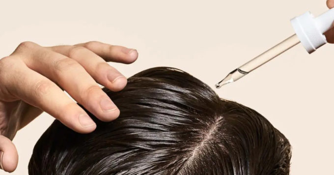 Hair Vitamins vs. Topical Hair Loss Treatments: Which is More Effective? 10 Hair Vitamins vs. Topical Hair Loss