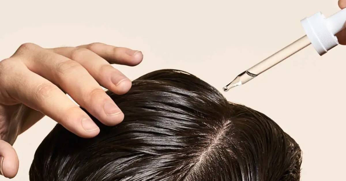 Hair Vitamins vs. Topical Hair Loss