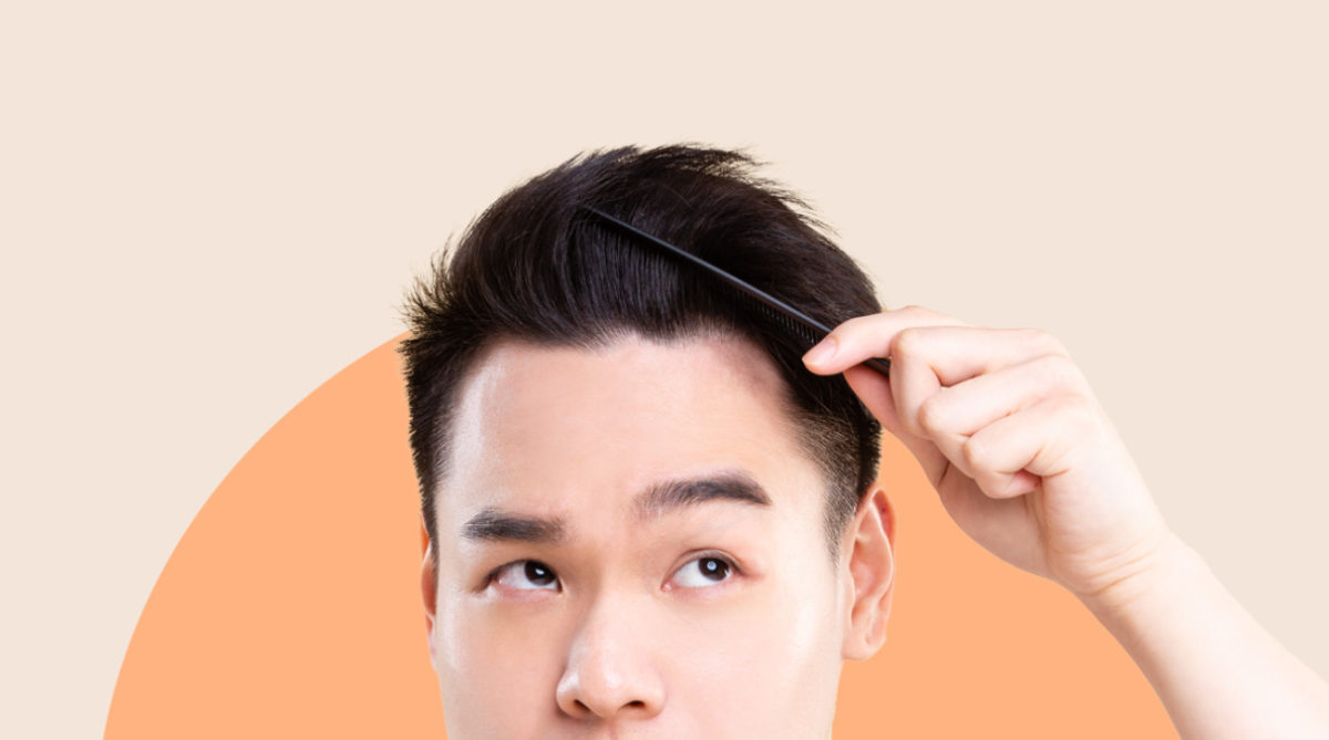 Hair Loss in Men