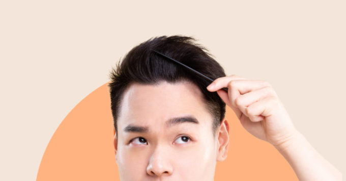 Hair Loss in Men – Types and Causes 8 Hair Loss in Men